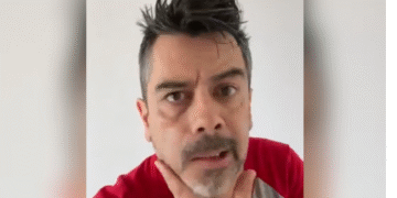 Carlos Espejel aparece con parálisis facial; atribuye su estado al estrés