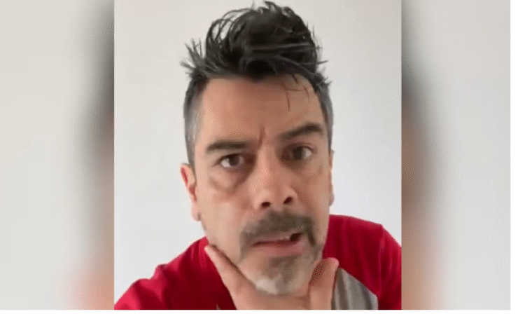 Carlos Espejel aparece con parálisis facial; atribuye su estado al estrés