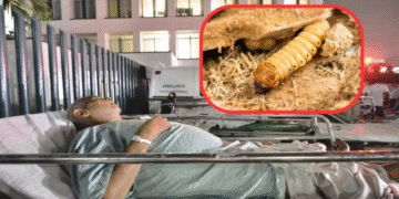 Suman cuatro casos de miasis por gusano barrenador en humanos en México