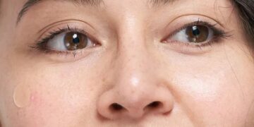 Hero Patch invita a amarte sin filtros