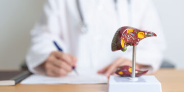 Nuevo modelo médico busca frenar la cuarta causa de muerte en México: crisis hepática