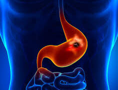 De lo invisible a lo urgente: la detección temprana del cáncer gástrico puede salvar vidas