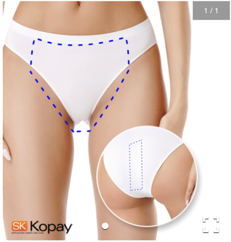 Kopay: depilación láser de barba, axilas y bikini en tendencia