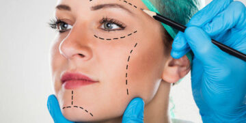 Más de 20 mil cirujanos plásticos operan sin certificación en México