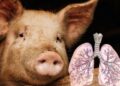 Cataluña reporta primer caso de gripe porcina en humano desde 2024