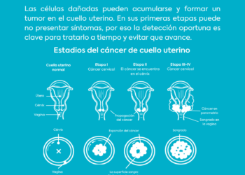 Día Mundial del Cáncer de Cuello Uterino: prevenir puede hacer la diferencia