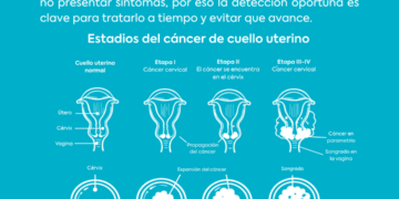 Día Mundial del Cáncer de Cuello Uterino: prevenir puede hacer la diferencia