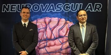 México incorpora innovación médica para aneurismas cerebrales